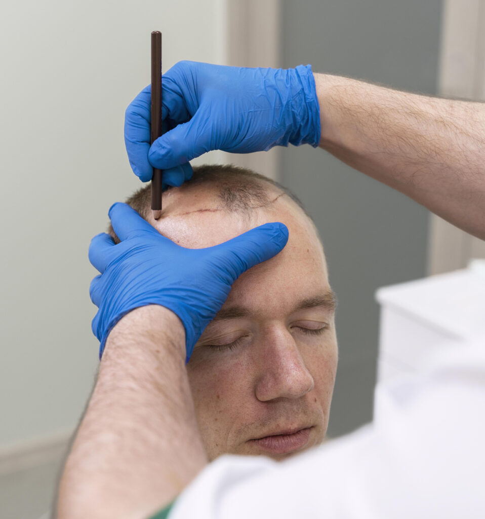 esteloom hair transplant clinic