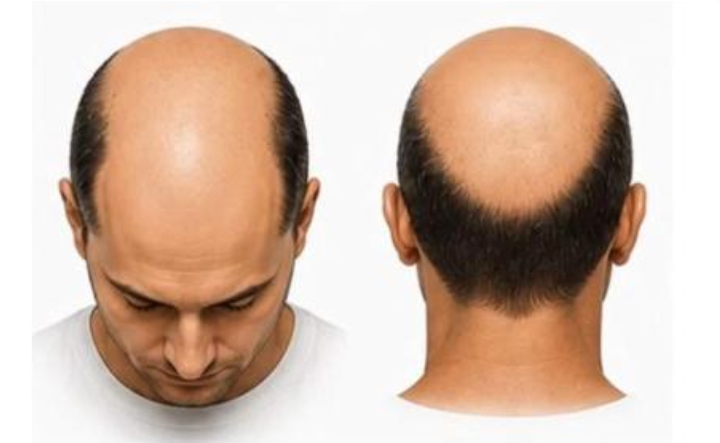 Hair condition option A
