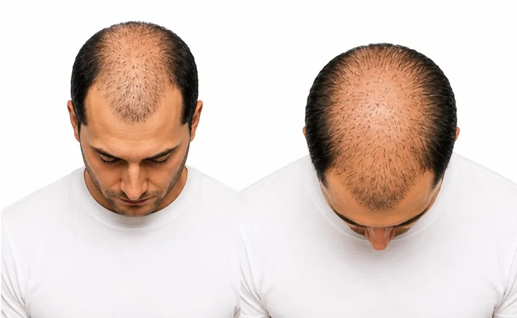 Hair condition option F